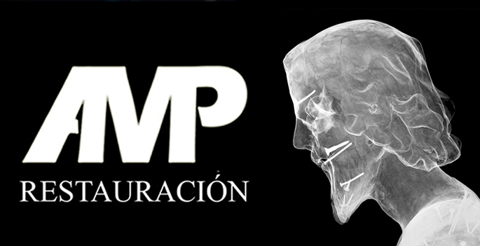 SALVAGUARDA del patrimonio del Altiplano&nbsp;murciano